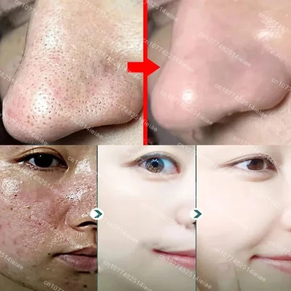 Original Facial Remove Blackhead Green Tea Solid Mask Treat Acne Blemish Black Dots Clean Stick Cream Shrink Pores Skin Care ﻿ - Image 2