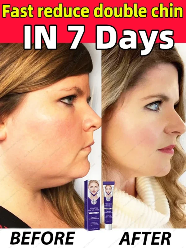 98% of customers feel their chubby face have been resolved