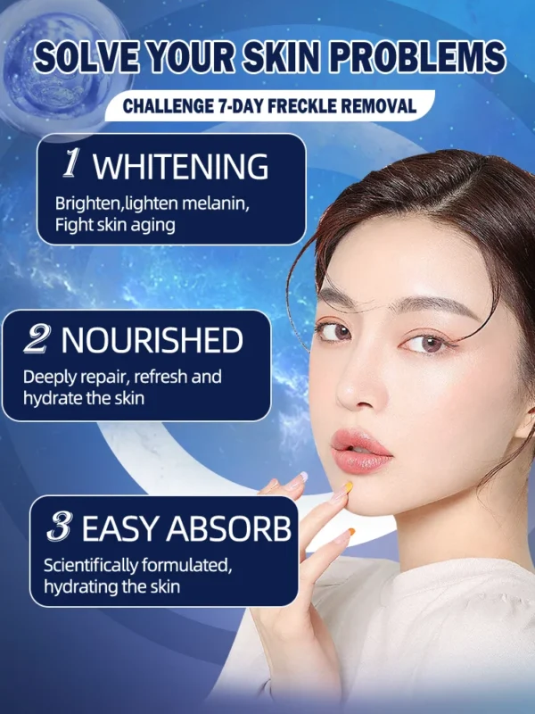 Freckle Whitening Cream Removal Dark Spots Melasma - Image 4