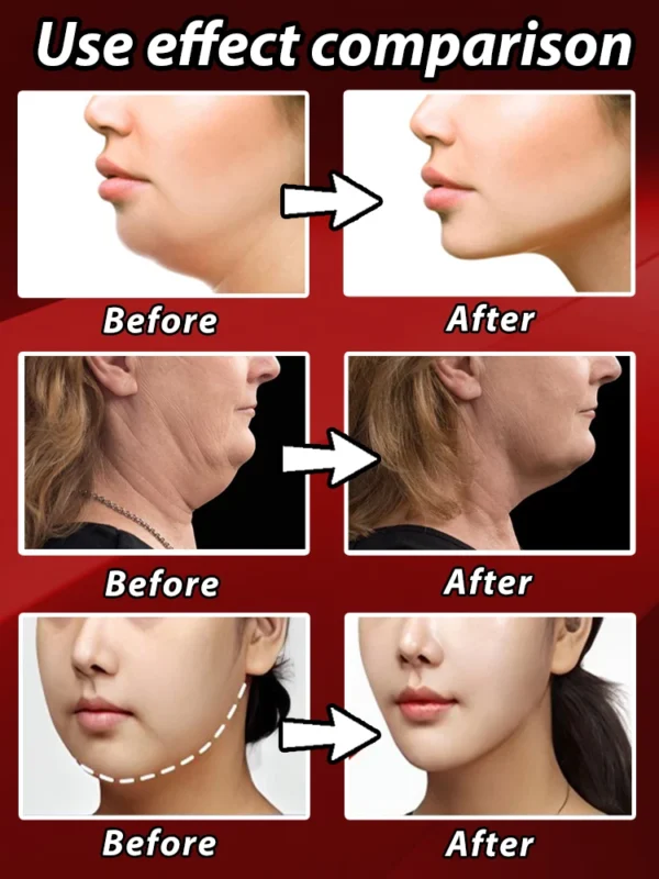 98% of customers feel their chubby face have been resolved - Image 3