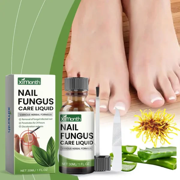 Onychomycosis Hand Foot Removal Repair Care Nail Fungal Treatment Serum Anti Infection Toe Fungus Paronychia 50g - Image 2