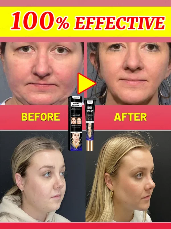 V Line Face Slimming Double Chin Eliminate Slimming the Face Face Slimming Cream Artifact Products - Image 5