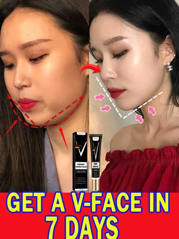 V Line Face Slimming Double Chin Eliminate Slimming the Face Face Slimming Cream Artifact Products - Image 2