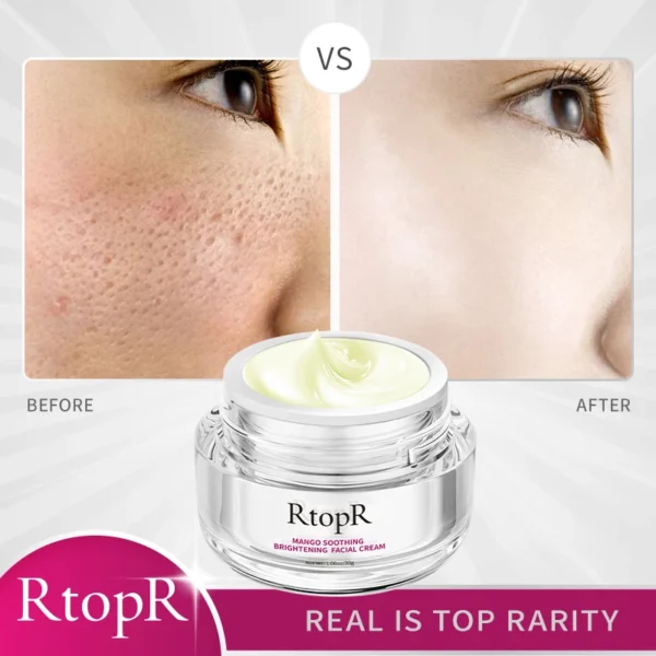 RtopR Face Cream Anti-Wrinkle Anti Aging Whitening Mango Bright Moisturizing Liquid Tights Nourishing Shrink Pores High Quality - Image 2