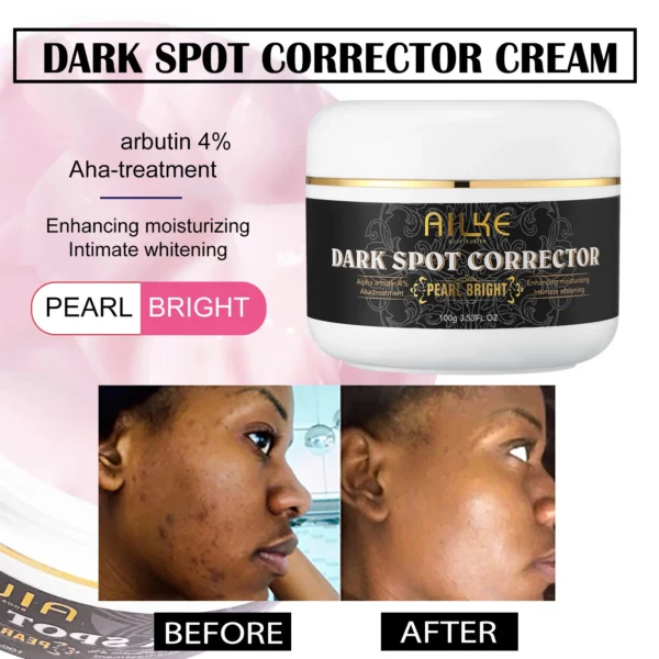 Ailke Facial and Body Dark Spot Correction Cream, Whitening Skin, Reducing Sun Dark Spot, Age Spot, Freckles, Melanin, and Melas - Image 3