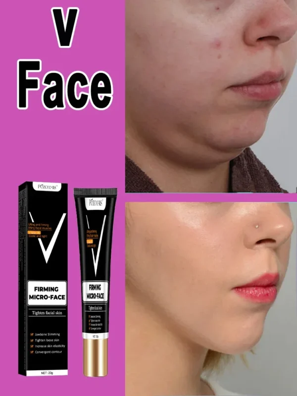 V Line Face Slimming Double Chin Eliminate Slimming the Face Face Slimming Cream Artifact Products - Image 3