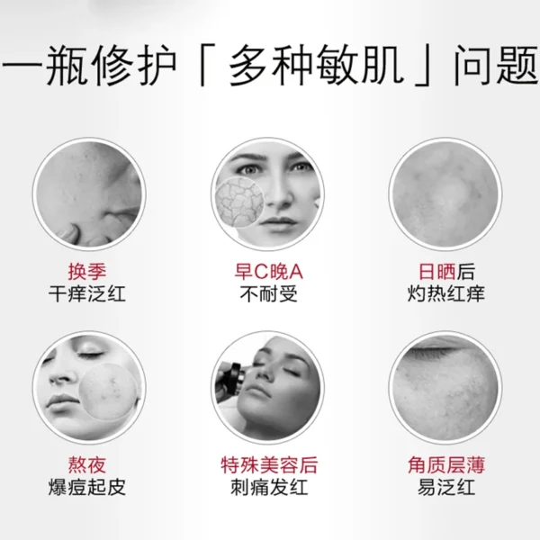 Winona Soothing Sensitive Moisturising Face Cream 15ML Sensitive Skin Hydration Barrier Repair Cream Highly Recommend Skincare - Image 5