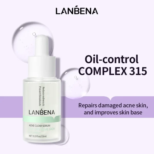 LANBENA 10% Salicylic Acid Oil Control Complex 315 Face Serum Acne Clear Essence - Image 2